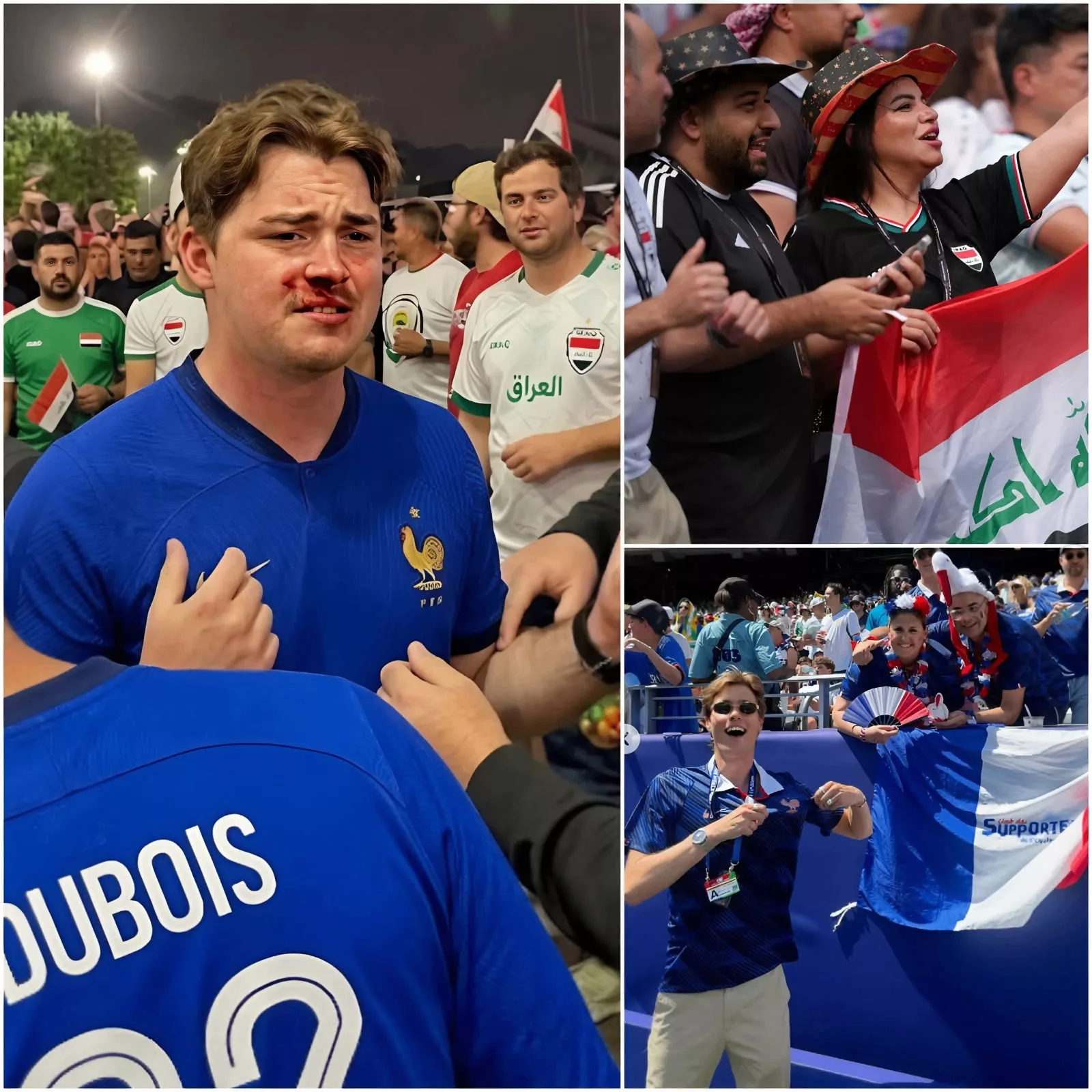 Des supporters français ont été attaqués par des supporters irakiens à l'extérieur du stade après la victoire écrasante 3-0 de l'équipe de France contre l'Irak. L'incident s'est produit peu après le coup de sifflet final, lorsque les tensions entre les deux groupes de supporters ont dégénéré en affrontements.